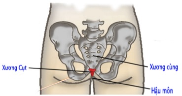 Nguyên nhân phổ biến gây đau xương hậu môn